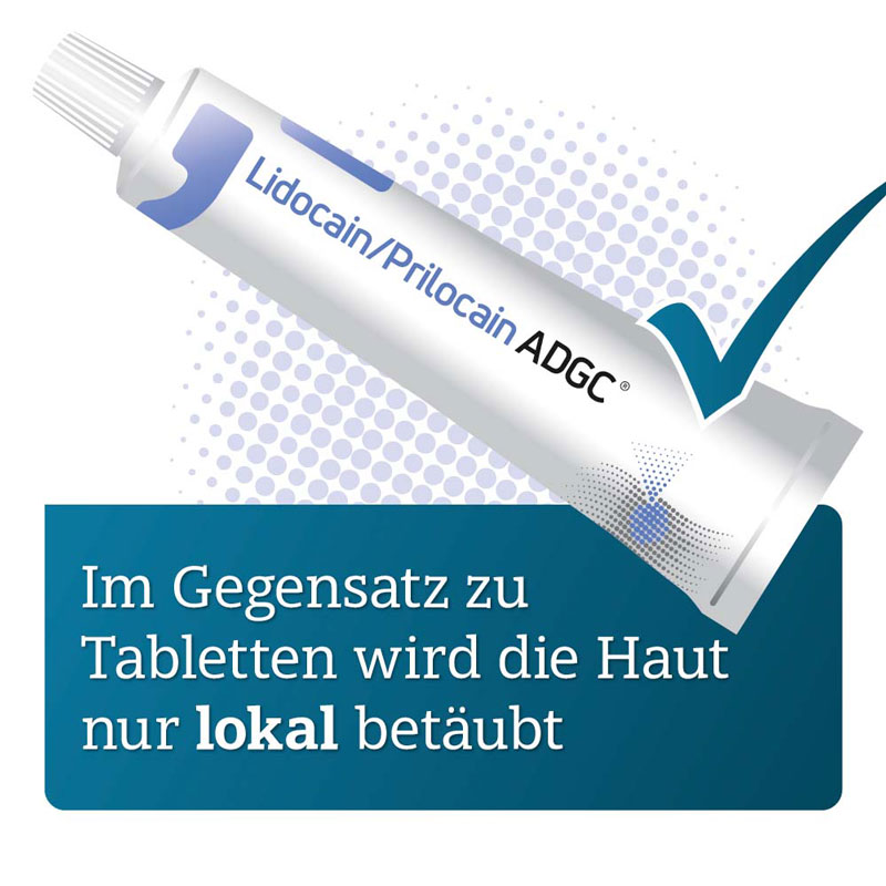 Lidocain/Prilocain ADGC 25 mg/g + 25 mg/g Creme 30 g Creme