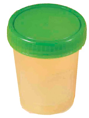 URINBECHER mit Schraubdeckel 1 St