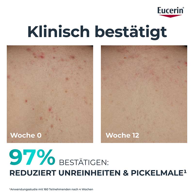 Eucerin DERMOPURE CLINICAL ERNEUERNDE KÖRPERPFLEGE 200 ml Körperpflege