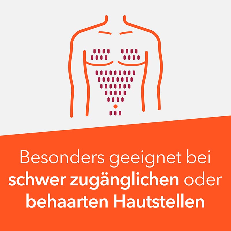 Hydrocortison-ratiopharm 0,5 %, Spray 30 ml Spray