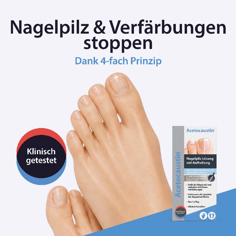 Acetocaustin Nagelpilz Lösung mit Aufhellung 9 ml Lösung