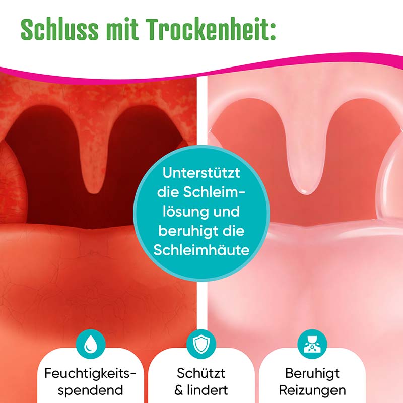 Transpulmin Hustensirup 180 ml Sirup
