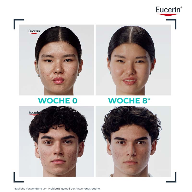 Eucerin DERMOPURE CLINICAL PROBIOM 8 1 St Creme