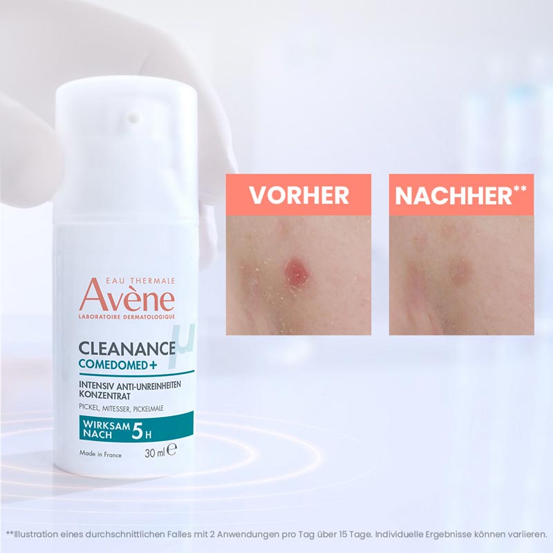 Avène CLEANANCE COMEDOMED+ 30 ml Konzentrat