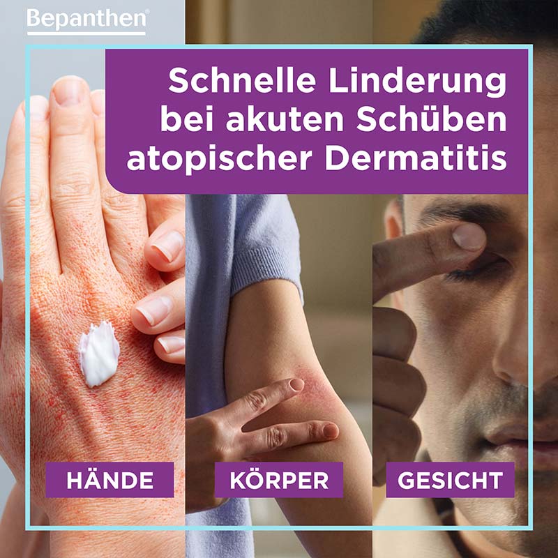 Bepanthen Sensiderm Anti-Juckreiz-Creme 50 g Creme