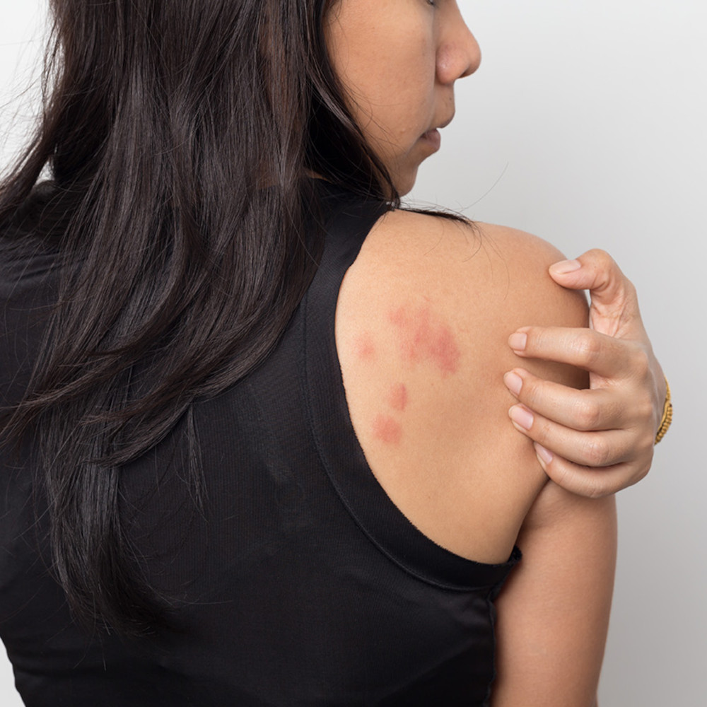 Deslora -1 A Pharma 5mg 50 St Filmtabletten