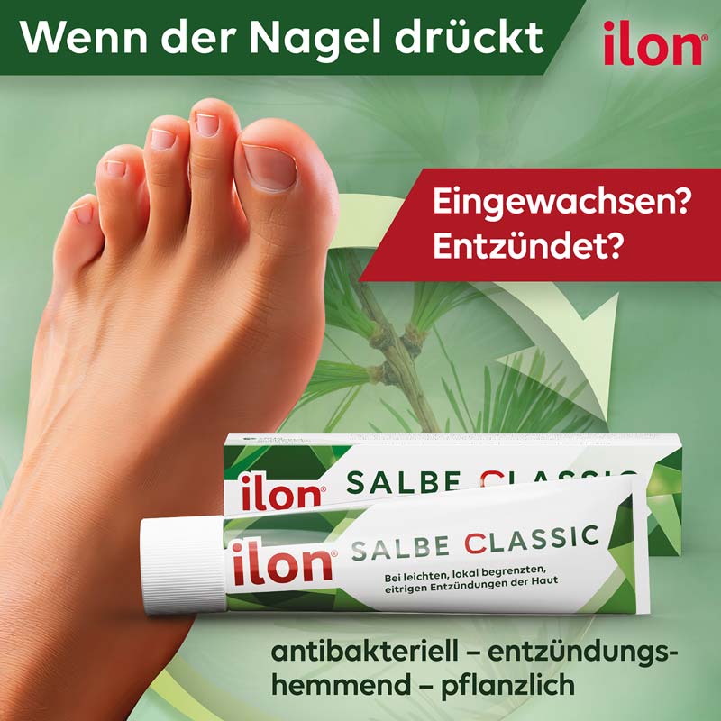 ilon SALBE CLASSIC 100 g Salbe