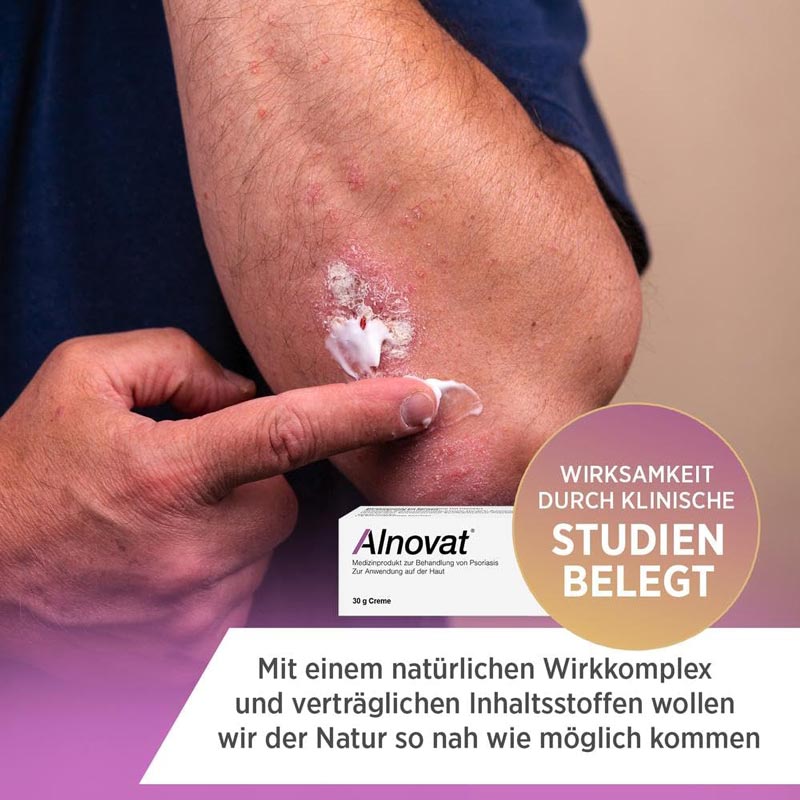 Alnovat 100 g Creme