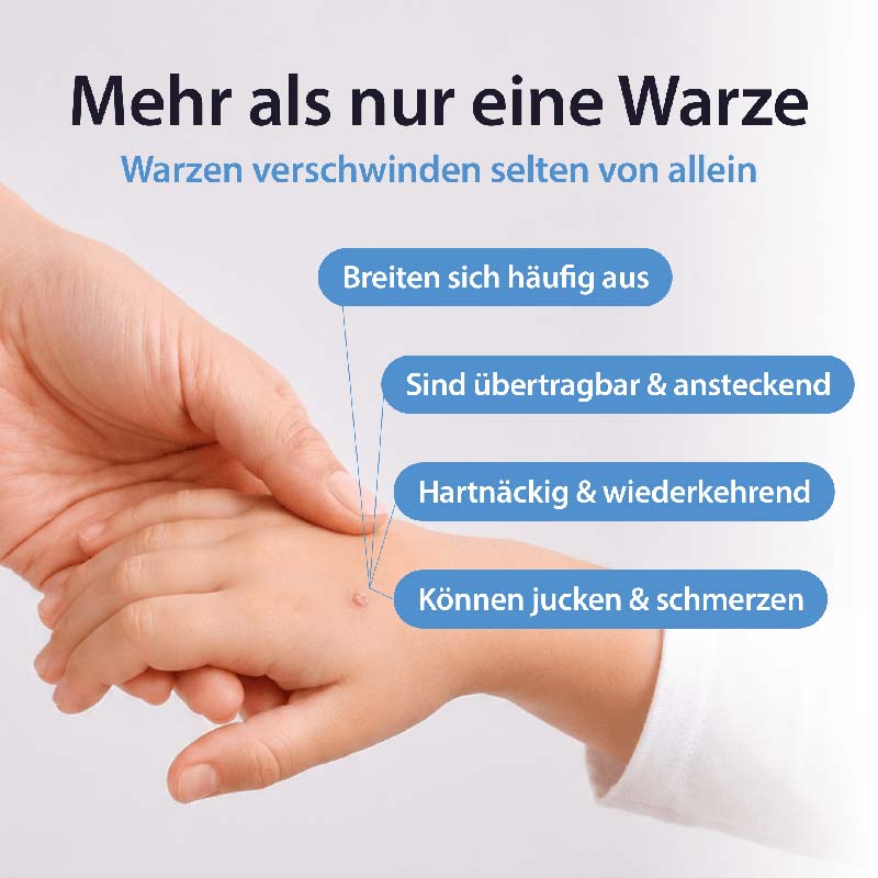 Acetocaustin Warzen Stift 3 ml Stifte
