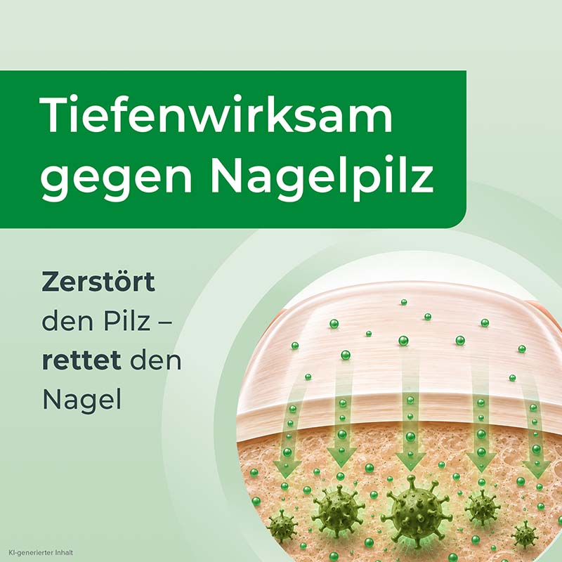 Ciclopoli gegen Nagelpilz Nagellack 3.3 ml Wirkstoffhaltiger Nagellack