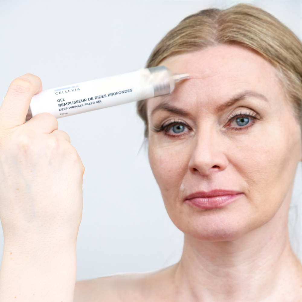 CELLEXIA Faltenfüllergel 10 ml Gel
