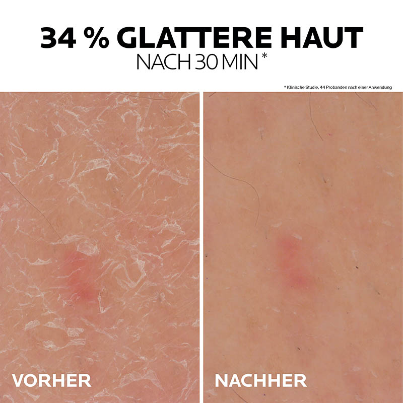 LA ROCHE-POSAY LIPIKAR UREA 30% ANTI-HORNHAUT GEL 50 ml Gel