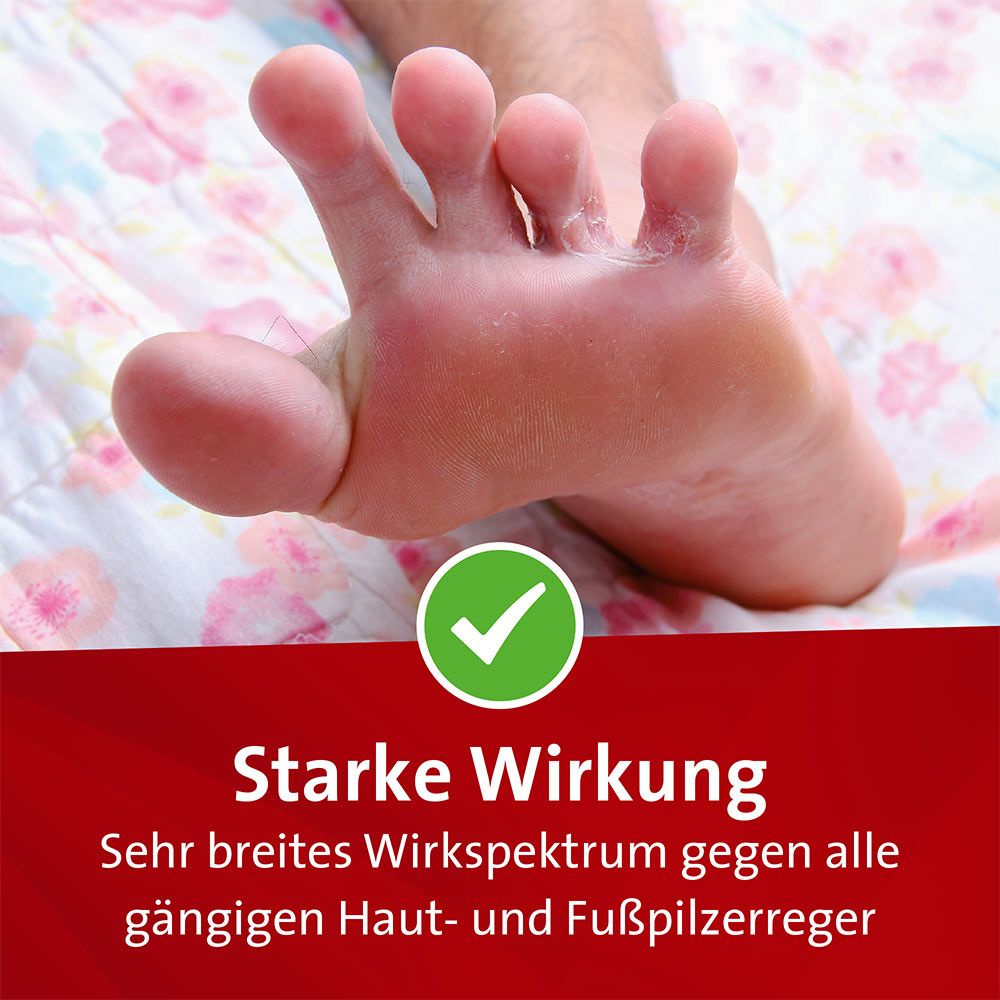 Mykosert Spray bei Haut- und Fußpilz 30 ml Lösung