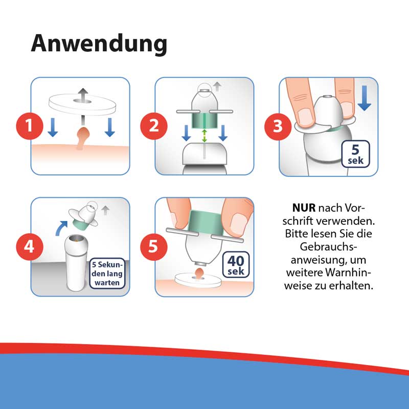 Acetocaustin Stielwarzen Entferner 50 ml Stifte