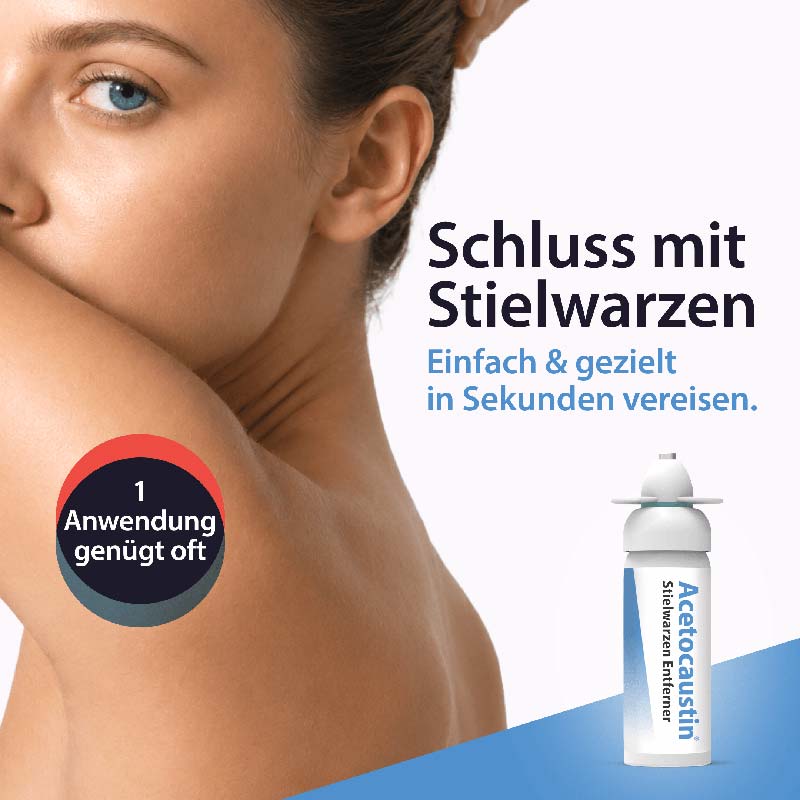 Acetocaustin Stielwarzen Entferner 50 ml Stifte