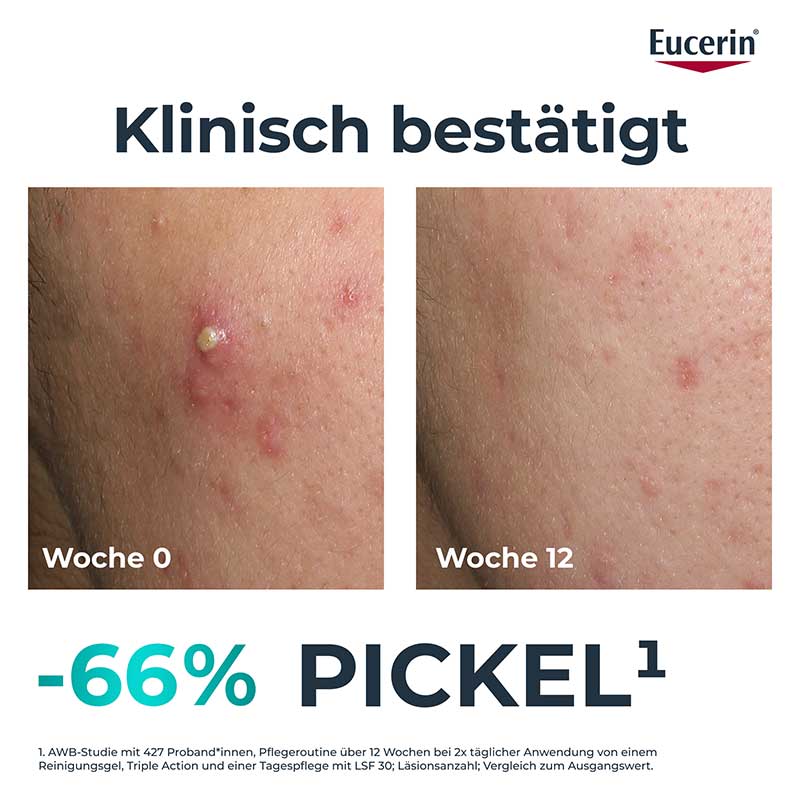 Eucerin DERMOPURE CLINICAL TRIPLE ACTION 40 ml Creme