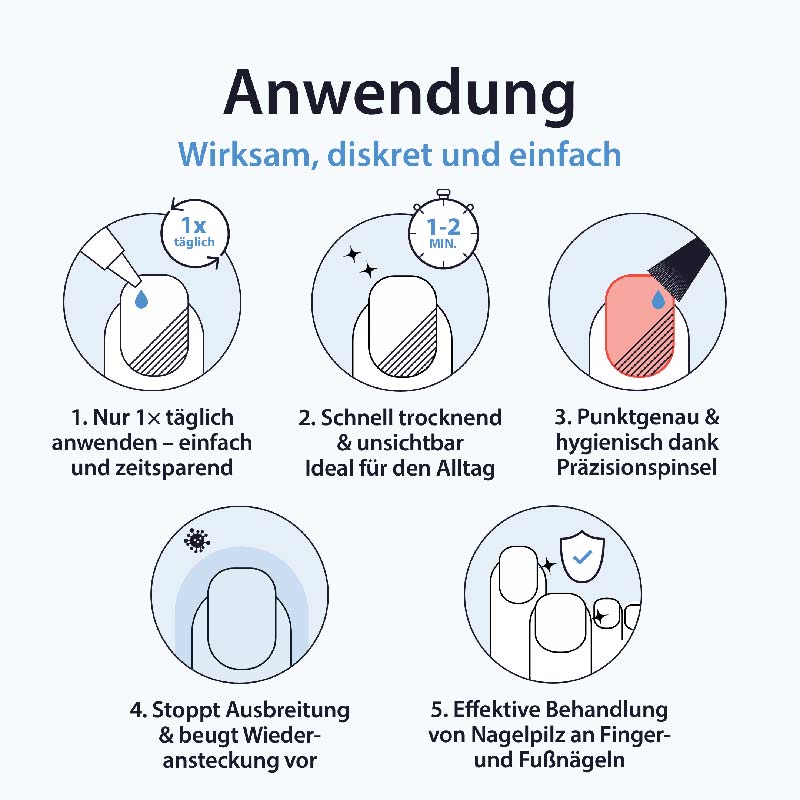 Acetocaustin Nagelpilz Lösung  5 ml Lösung