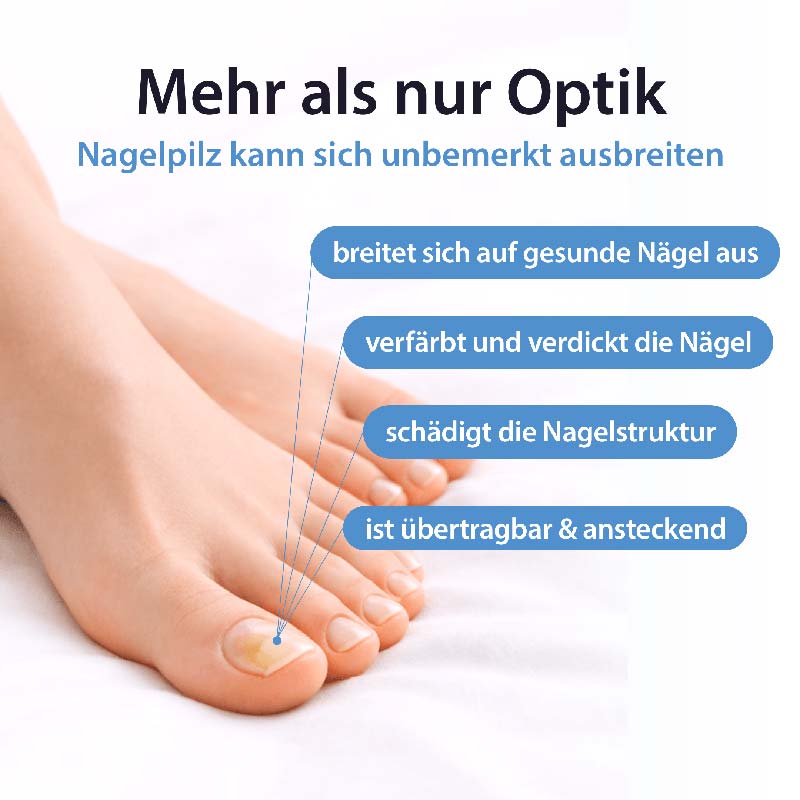 Acetocaustin Nagelpilz-Stift 4 ml Stifte