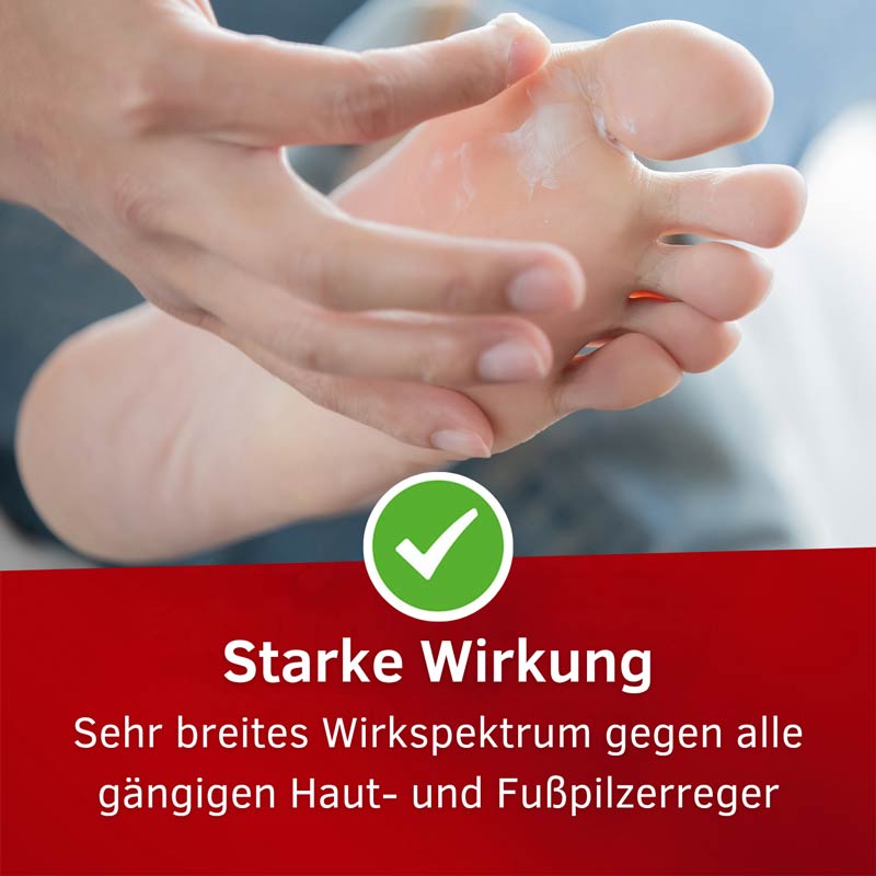 Mykosert Creme bei Haut- und Fußpilz 20 g Creme