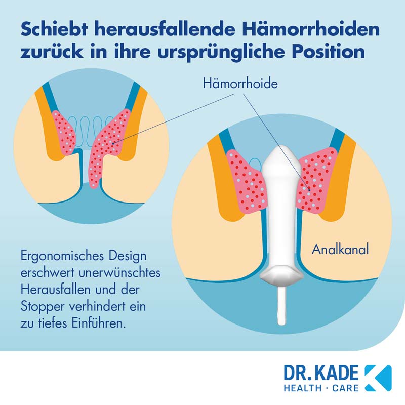 POSTERICARE Hämorrhoiden-Stick 1 St