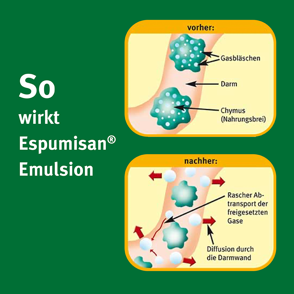 Espumisan EMULSION 3X32 ml Emulsion
