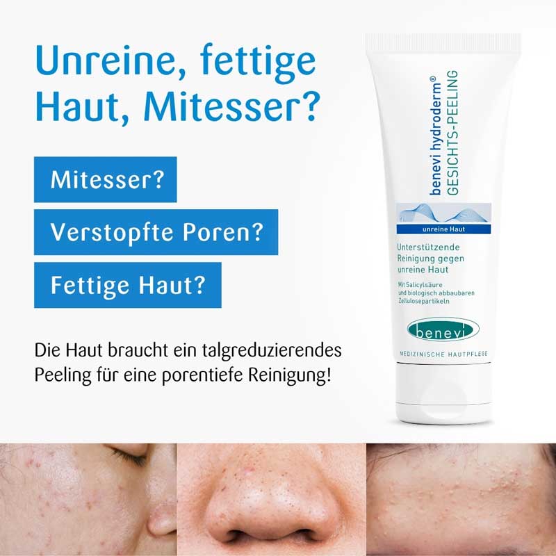 BENEVI Hydroderm Gesichts-Peeling 75 ml Gel