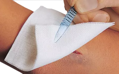 VLIWASOFT Vlieskompressen 10x10 cm unsteril 6l. 100 St Kompressen