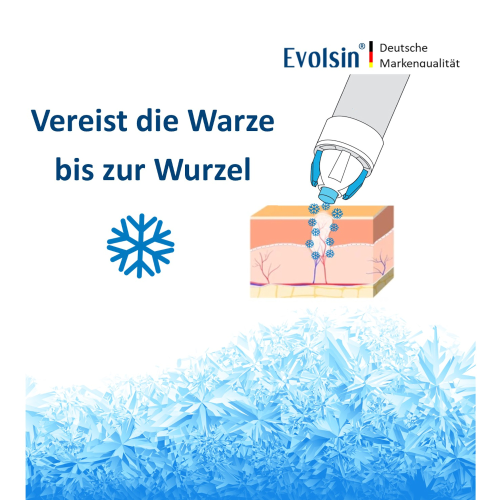 Evolsin Warzenvereiserspray 75 ml Spray