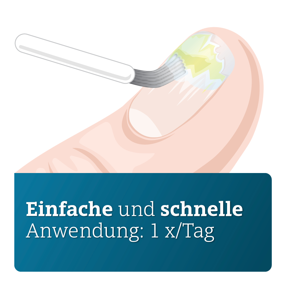 CICLOPIROX ADGC 80 mg/g Nagellack 3.3 ml Wirkstoffhaltiger Nagellack