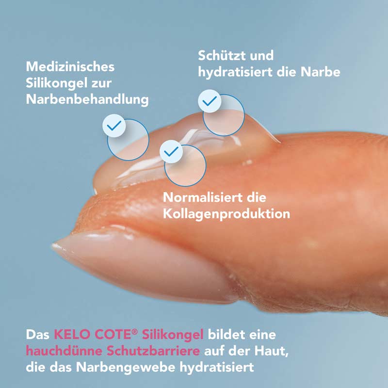 KELO-COTE Silikon Gel zur Behandlung von Narben 60 g Gel