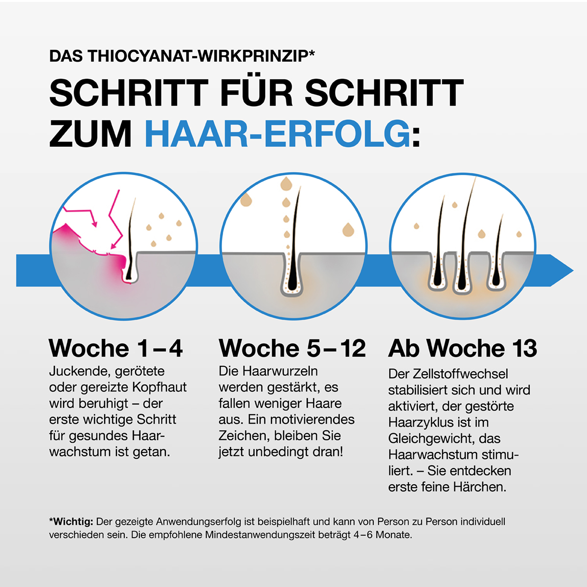 Thiocyn Haarserum Männer 150 ml Flüssigkeit