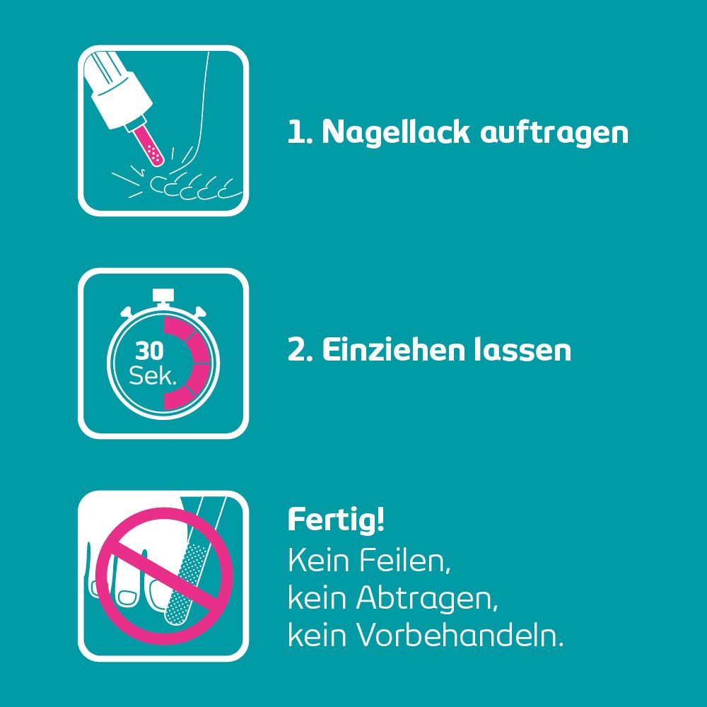 Terbinafin -1 A Pharma 3.3 ml Wirkstoffhaltiger Nagellack