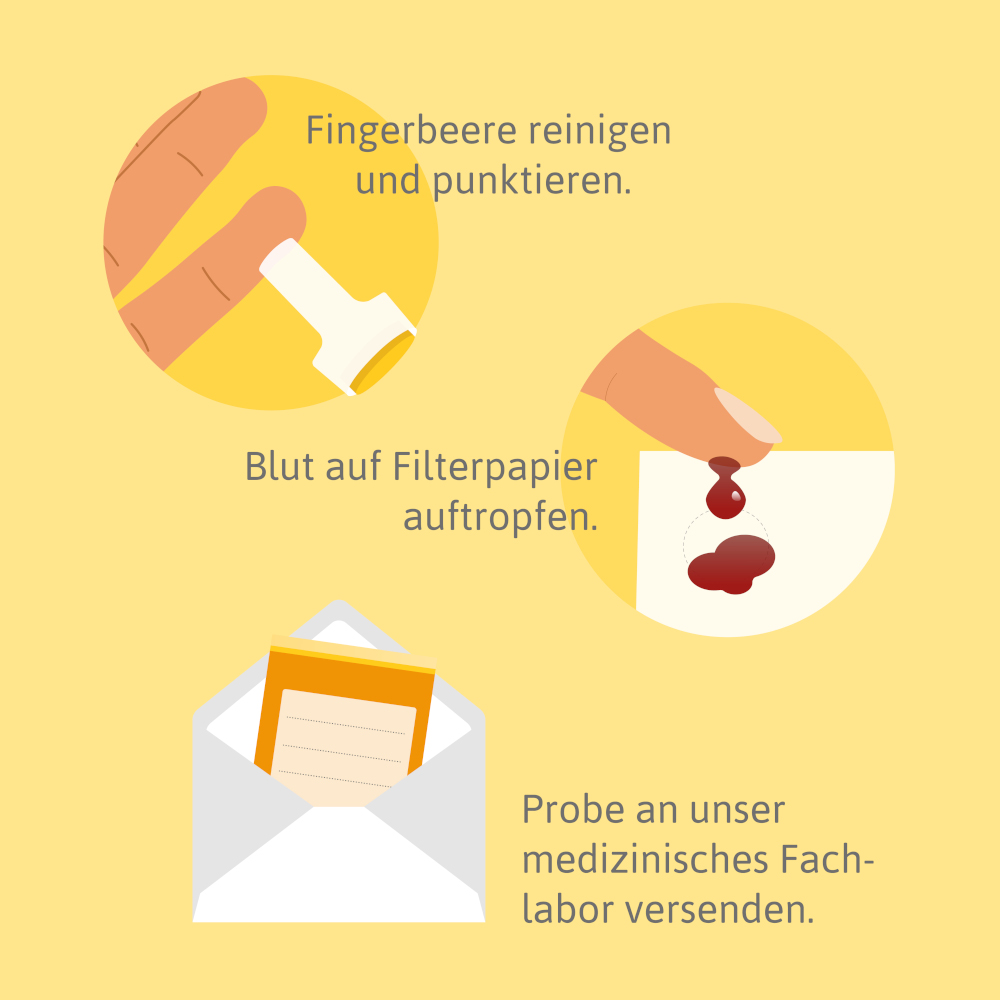 PreventID Vital-D Vitamin D Trockenbluttest 1 St Test