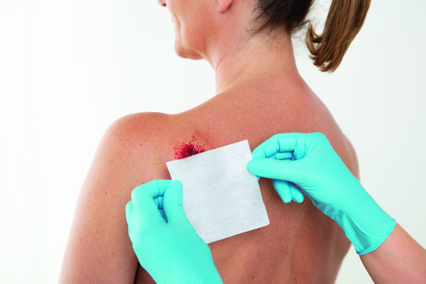 FIXOMULL stretch 5 cmx10 m 1 St