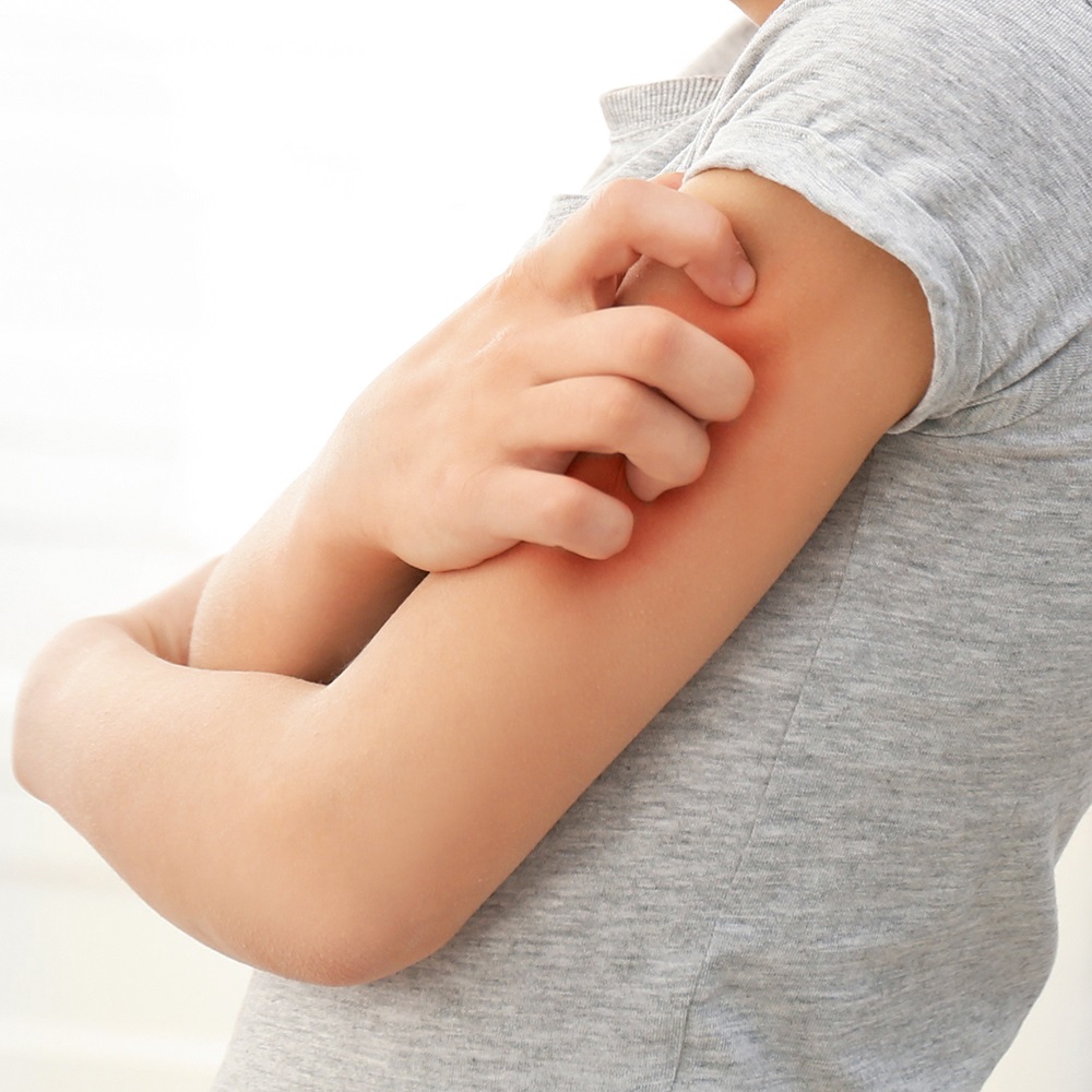 ALLERGIKA Dermifant Kinderlotion AKUT 200 ml Lotion