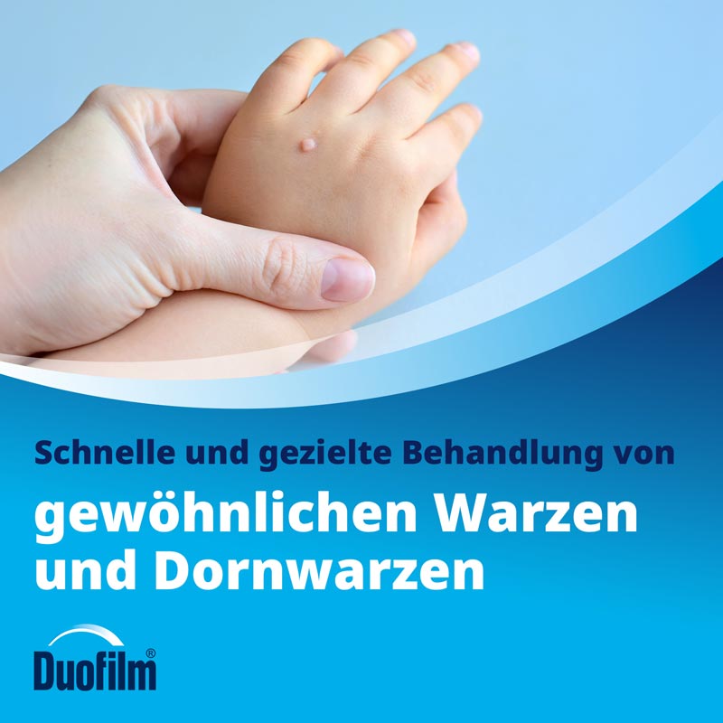 Duofilm 15 ml Lösung