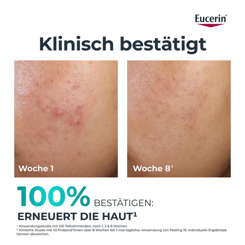 Eucerin DERMOPURE CLINICAL PEELING 10 40 ml Nachtcreme