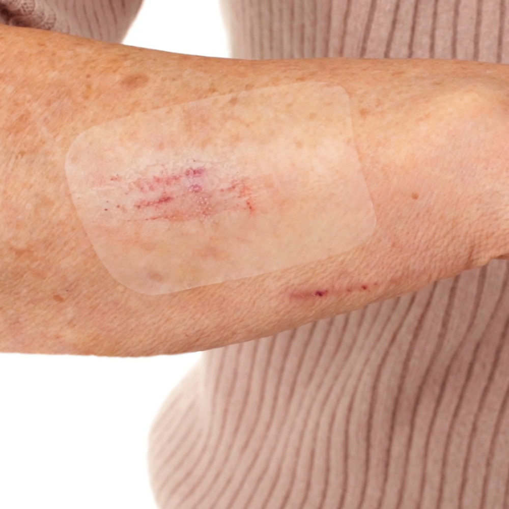 Leukomed T skin sensitive transparenter Folienverband 5 x 7,2 cm 5 St Pflaster