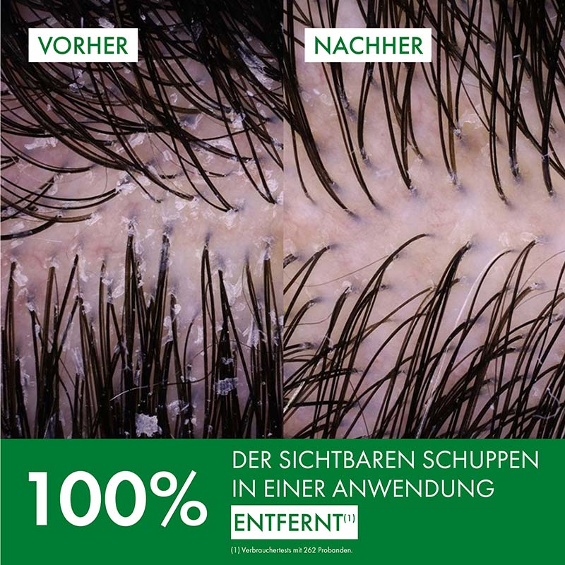 VICHY DERCOS Anti-Schuppen DS INTENSIV-SHAMPOO  390 ml Shampoo
