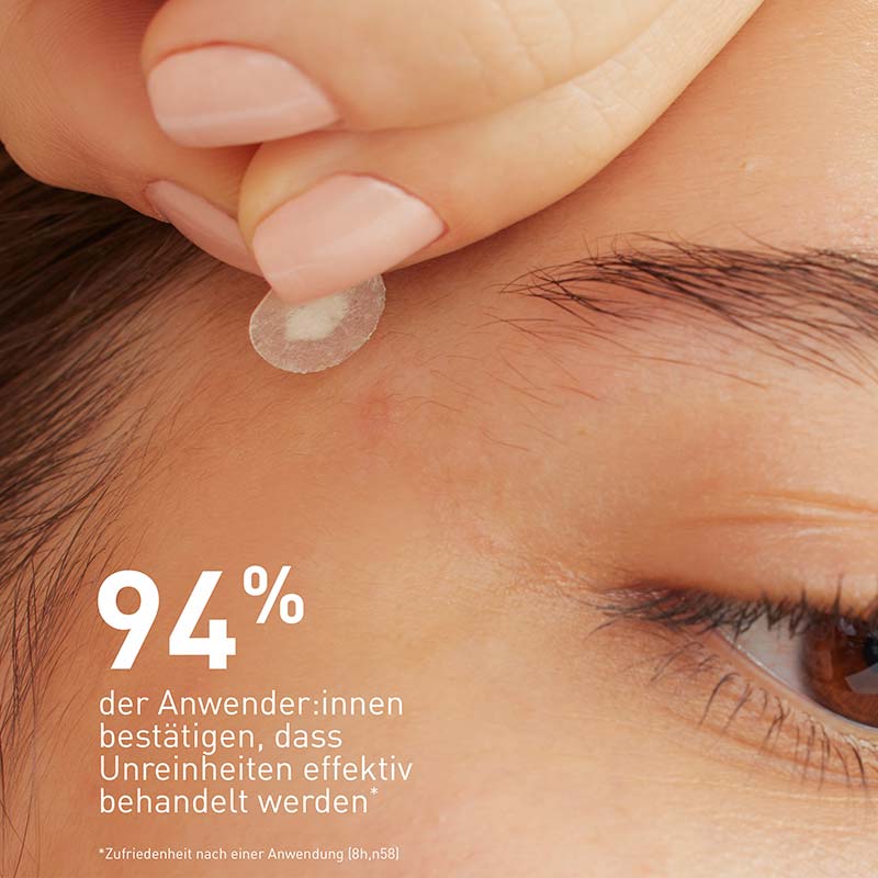 CeraVe Anti-Unreinheiten Patches 22 St Pflaster