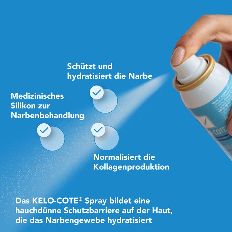 KELO-COTE Silikonspray 100 ml Spray