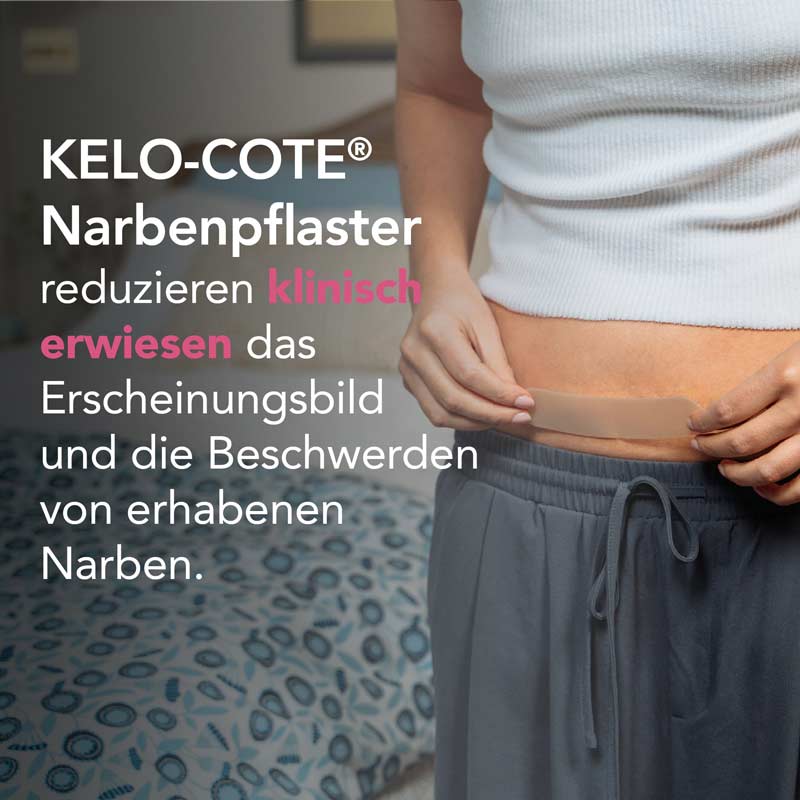 KELO-COTE NARBENPFLASTER KAISERSCHNITT  1 St Pflaster
