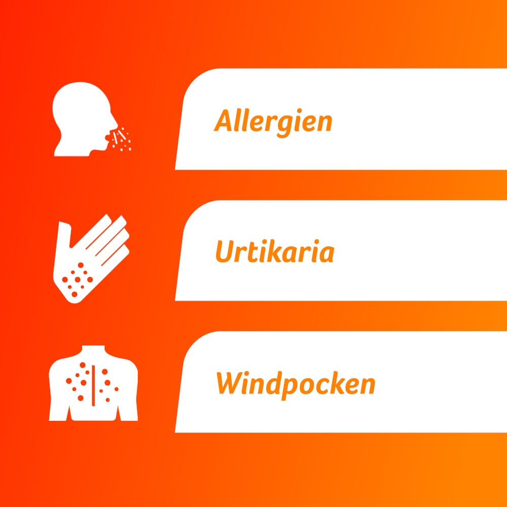 Fenistil  50 St Überzogene Tabletten