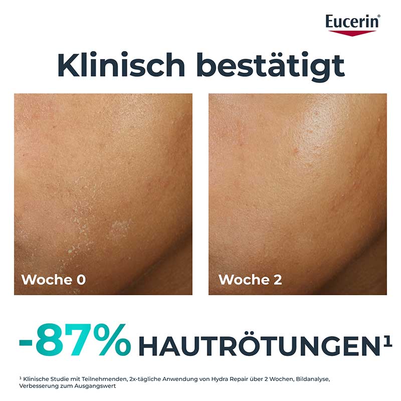 Eucerin DERMOPURE CLINICAL HYDRA REPAIR 40 ml Creme