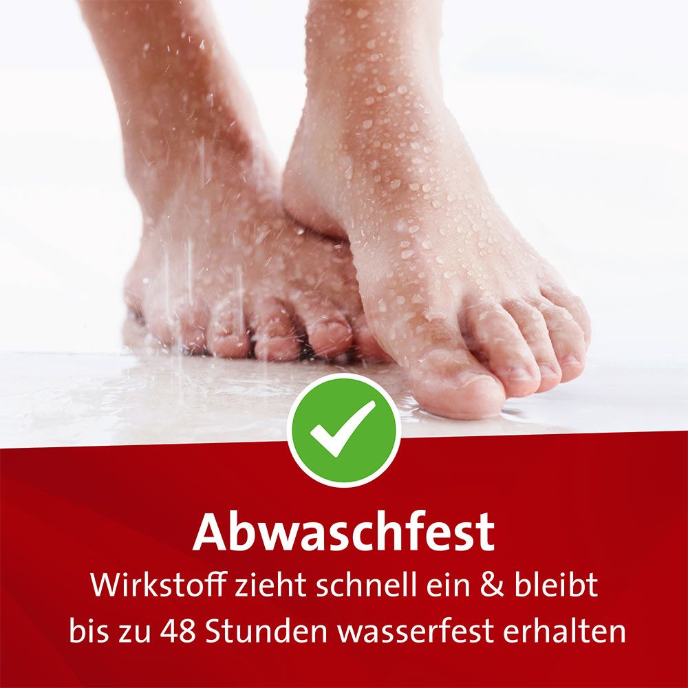 Mykosert Spray bei Haut- und Fußpilz 30 ml Lösung