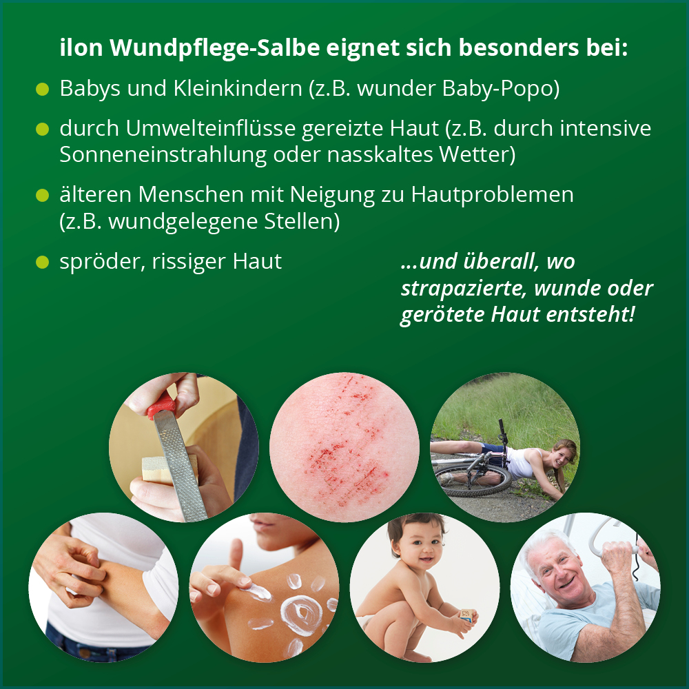 ILON Wundpflege-Salbe 50 ml Salbe