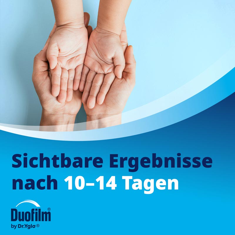 Duofilm Vereisungsspray gegen Warzen 50 ml Spray