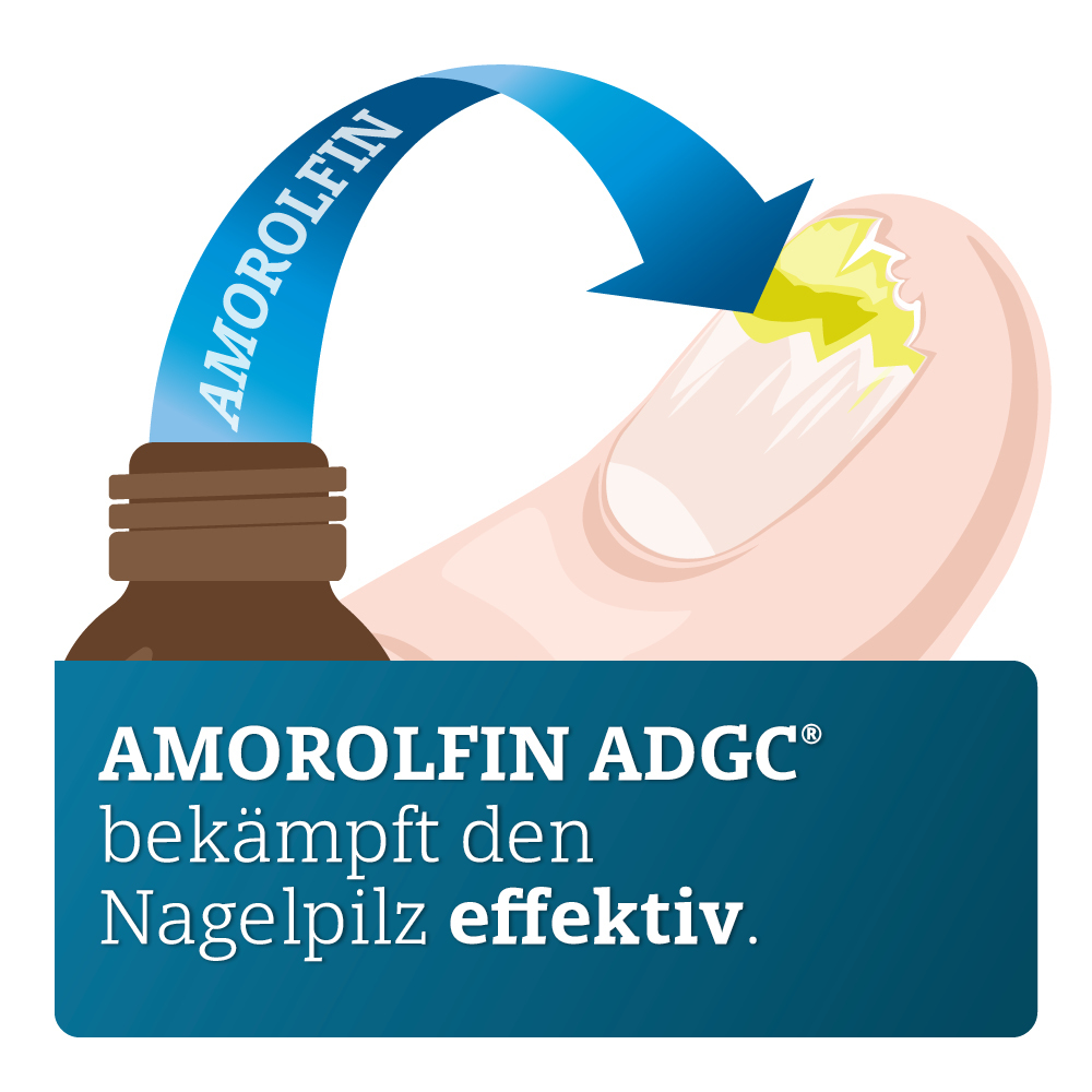 AMOROLFIN ADGC 50MG/ML 3 ml Wirkstoffhaltiger Nagellack