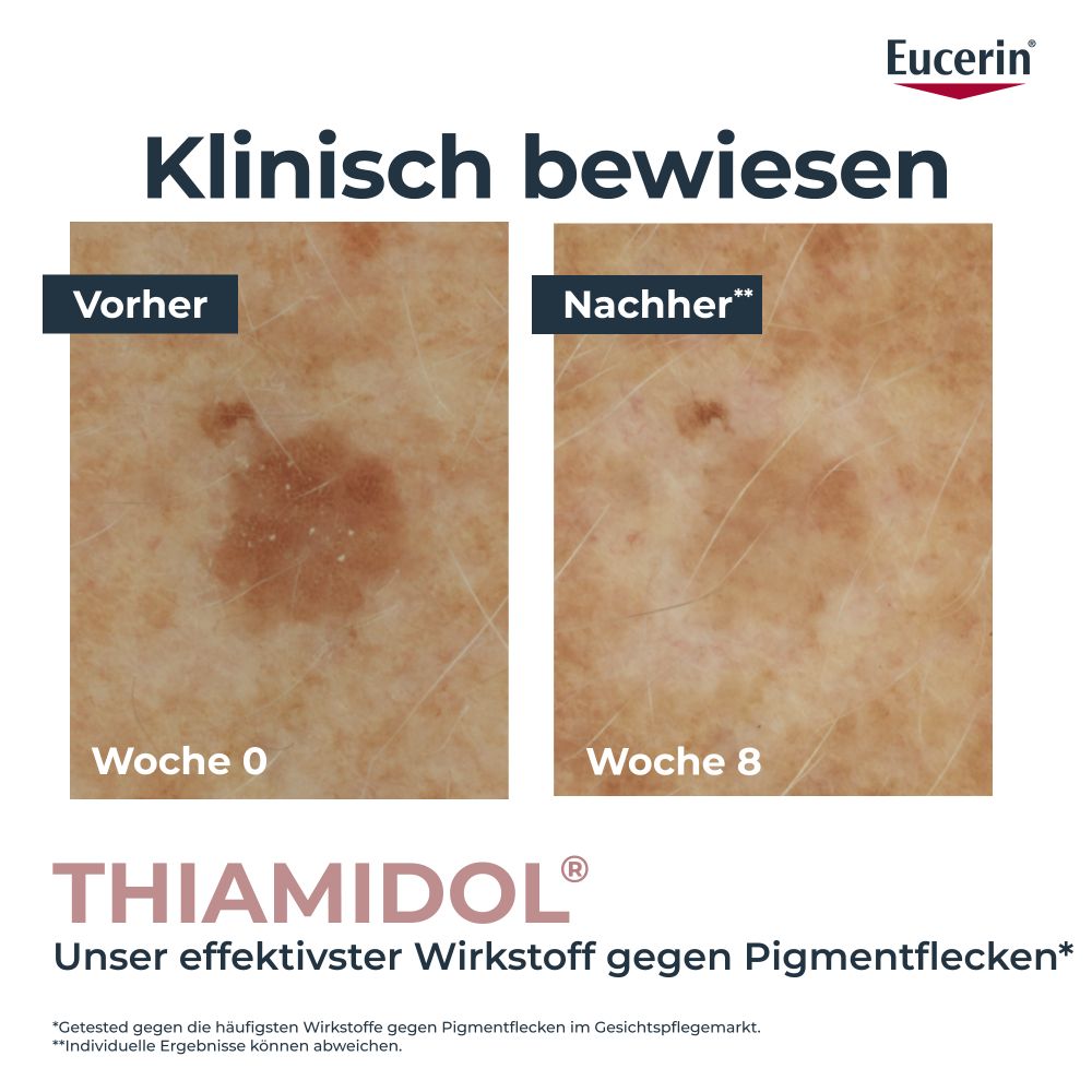 Eucerin ANTI PIGMENT KORREKTURSTIFT 5 ml Stifte