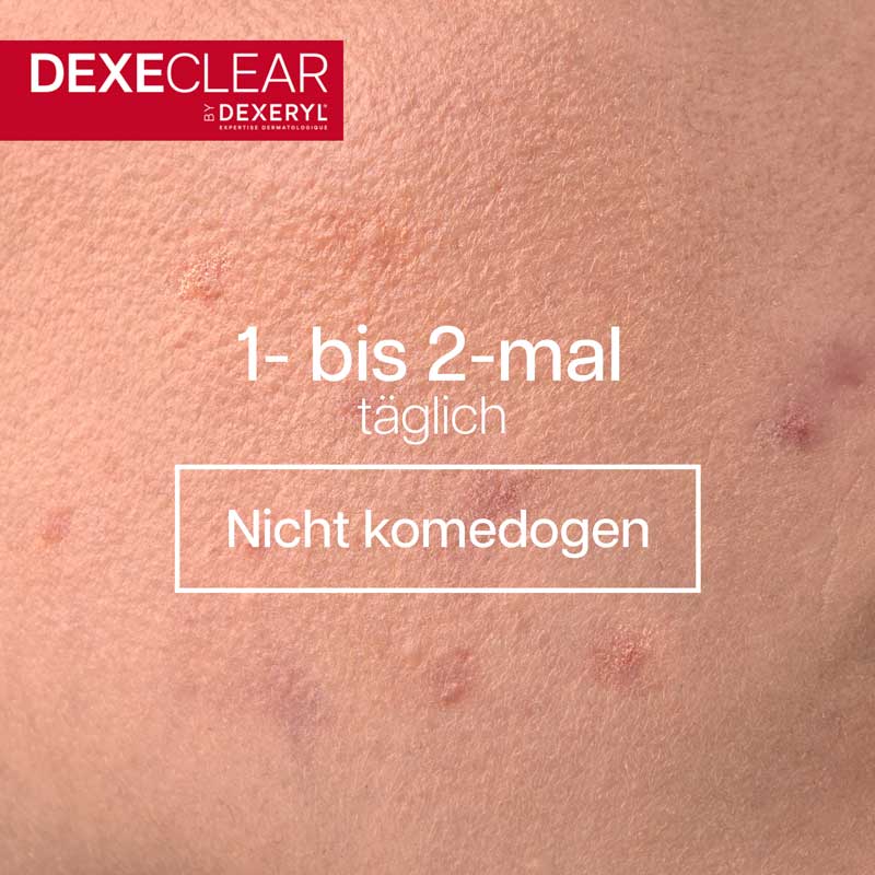 DEXECLEAR feuchtigkeitsspendende, beruhigende Reinigung 200 ml Gel
